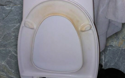 That Gross Yellow Ring? Here’s How I Actually Got Rid of Toilet Stains