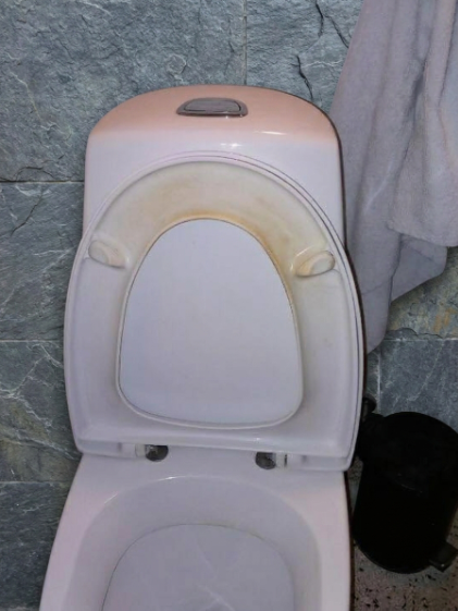 That Gross Yellow Ring? Here’s How I Actually Got Rid of Toilet Stains