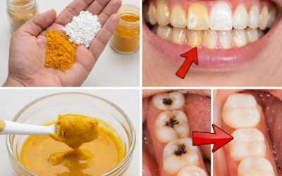Turmeric for Teeth Whitening: Does This Natural Remedy Really Work?