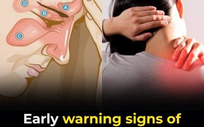 9 Sneaky Early Signs of Diabetes You Could Miss