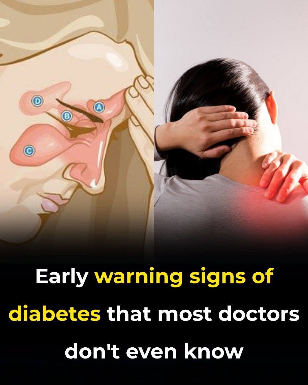 9 Sneaky Early Signs of Diabetes You Could Miss