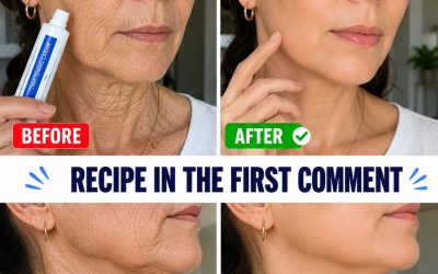 “It looks like I had plastic surgery”: The home remedy used to improve the appearance of wrinkles and dark spots on hands and arms. To keep getting my recipes, you just have to say… Thank you!