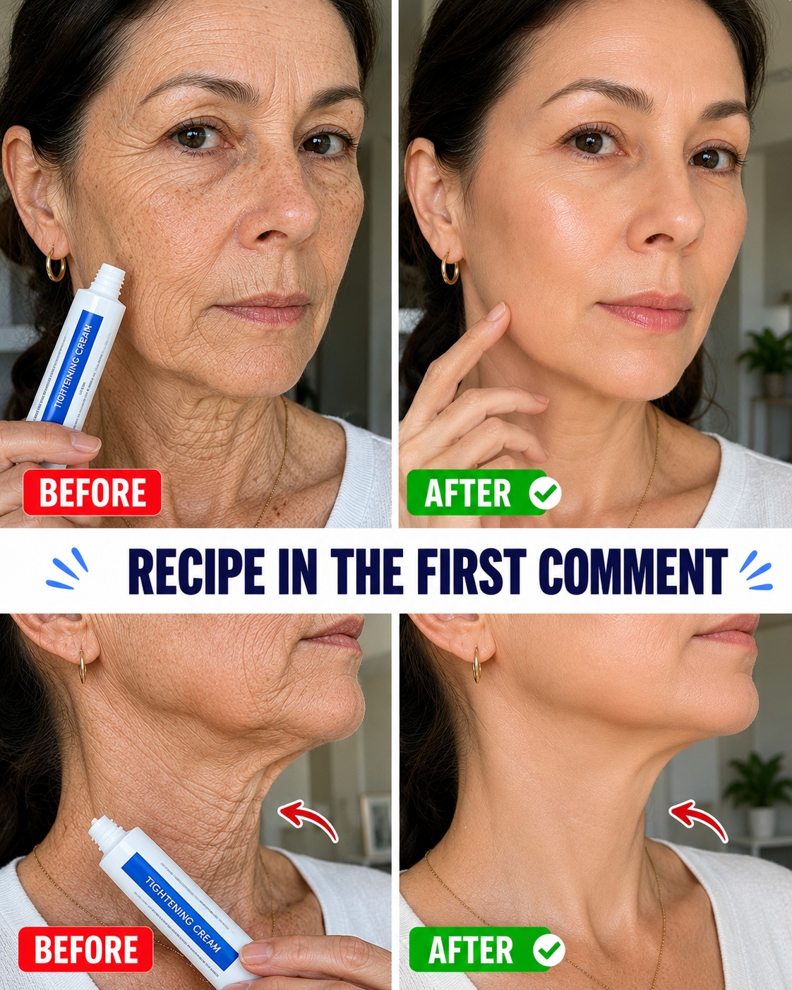 “It looks like I had plastic surgery”: The home remedy used to improve the appearance of wrinkles and dark spots on hands and arms. To keep getting my recipes, you just have to say… Thank you!