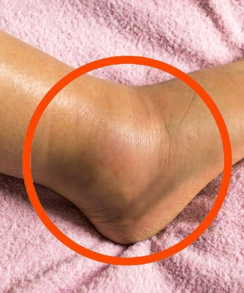 Swollen legs: what could it mean? Common causes you should never ignore.