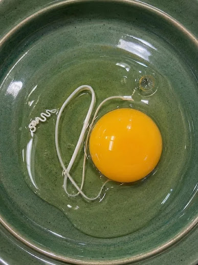 The Mystery of the White String in Your Egg: Why That “Worm” is Actually a Sign of Freshness (And Why You Should Keep It!)