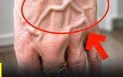 Did you know that having visible veins means you are…