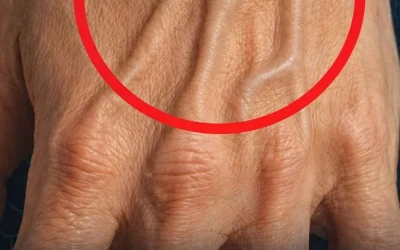 Why are your veins suddenly bulging and visible?