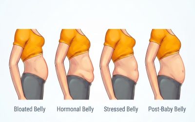 4 Types of Big Bellies That Aren’t Caused By Overweight