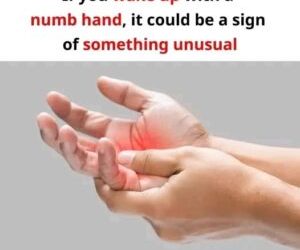 Waking Up with a Numb Hand: What It Could Mean