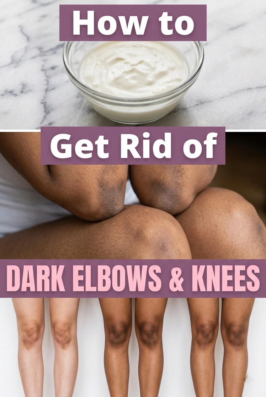 How to Get Rid of Dark Elbows and Knees: 7 Natural Remedies That Work