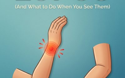 Is It Lupus? 10 Early Warning Signs You Need to Spot Now…