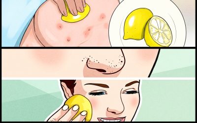 7 Ways To Use Lemon That Every Woman Should Know