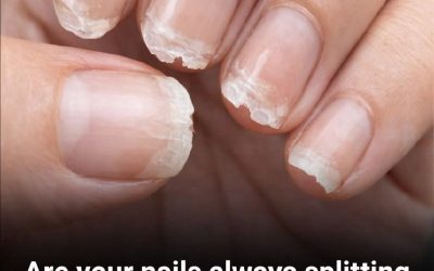 Brittle and Weak Nails: What Your Body Is Telling You