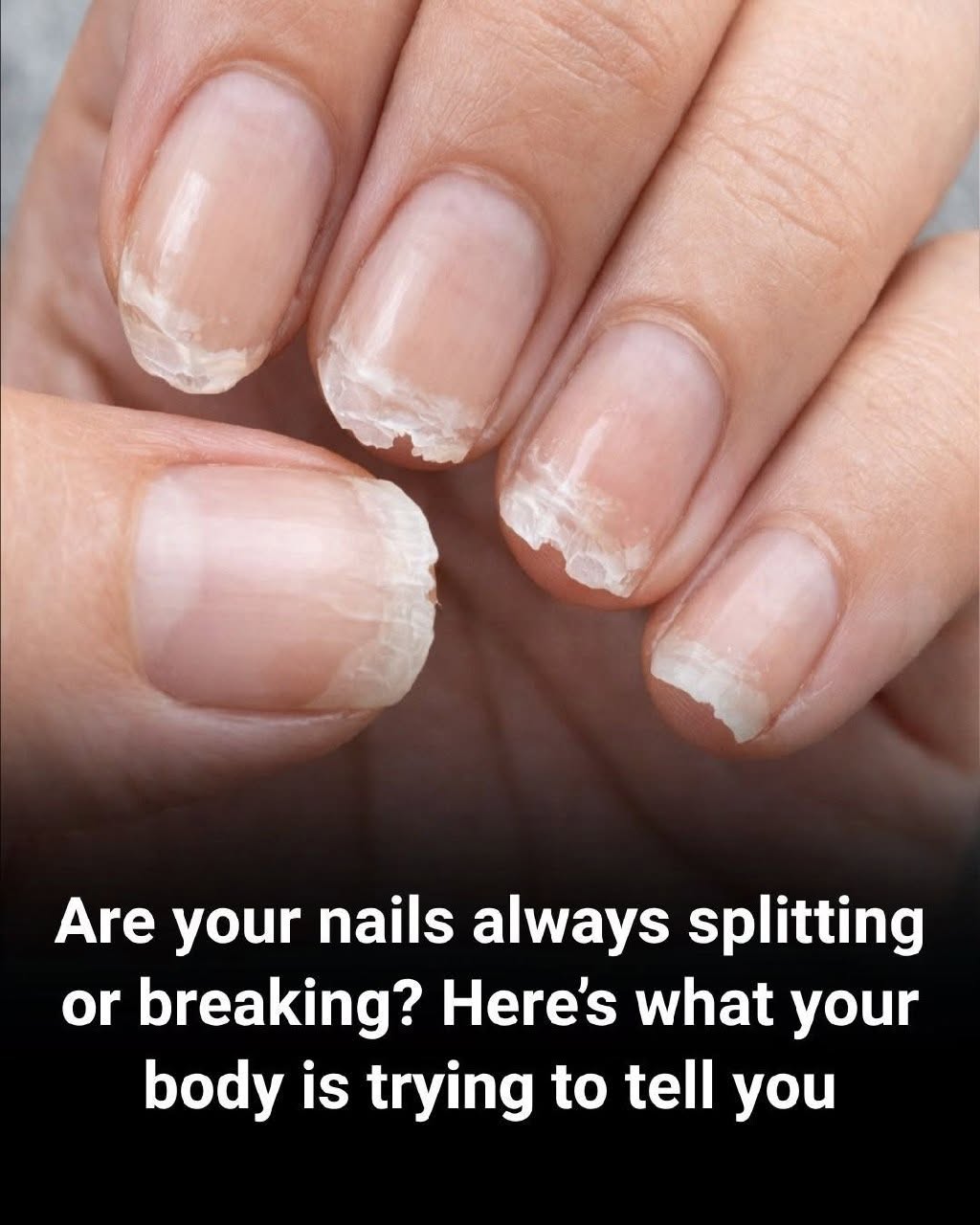 Brittle and Weak Nails: What Your Body Is Telling You