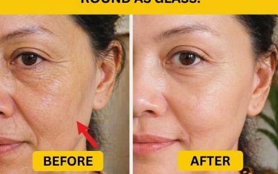 Make a baking soda cream and apply it before bed. Say goodbye to wrinkles and imperfections! To continue receiving my recipes, let me know… Thanks!